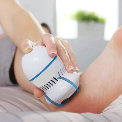 Nuvewave Vacuum Callus Remover